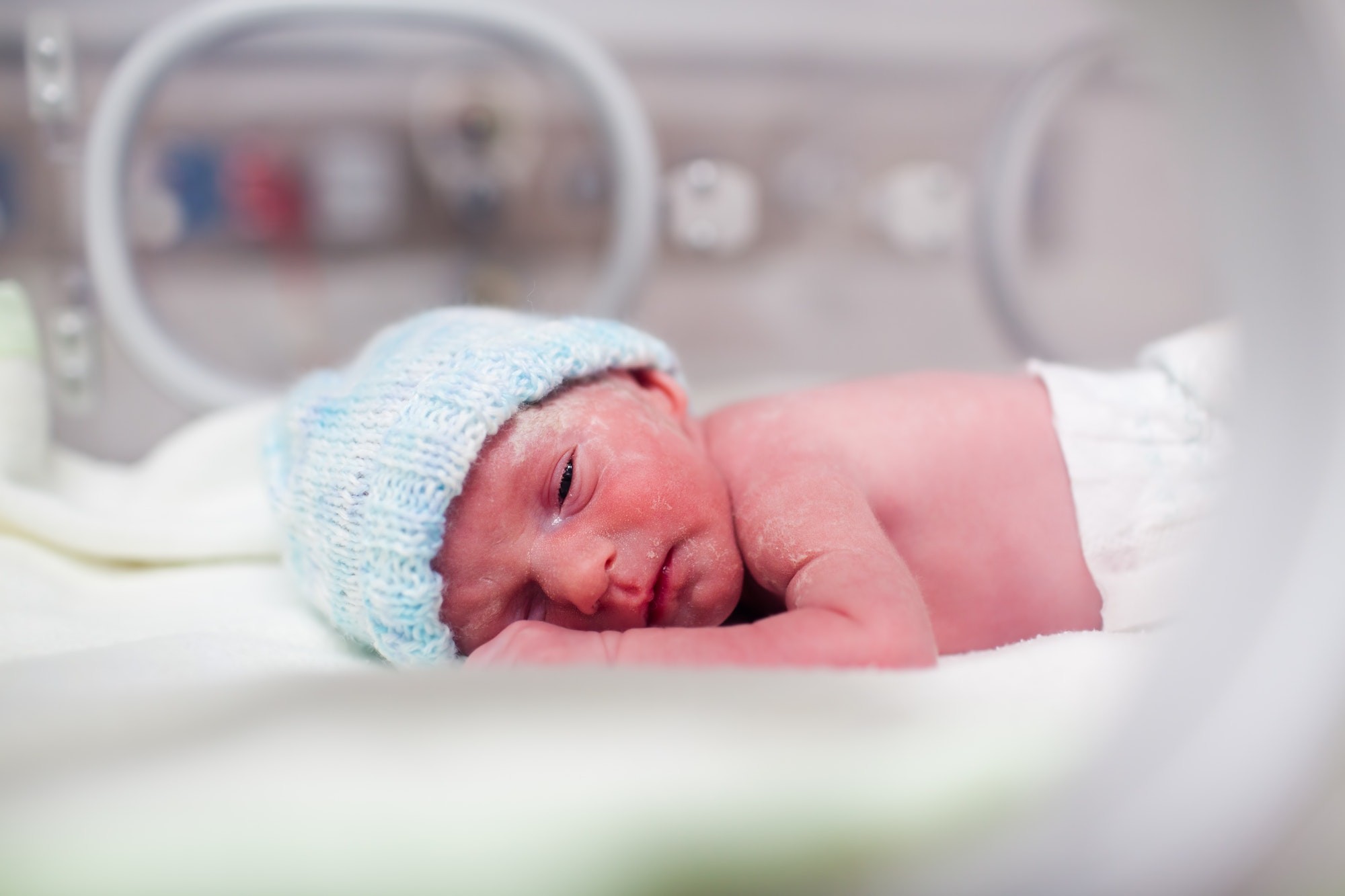 Newborn boy covered in vertix in incubator